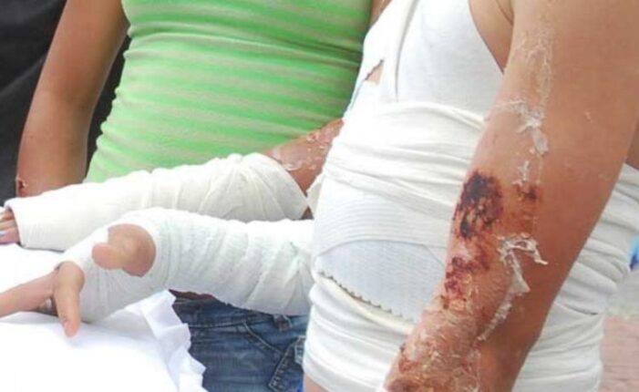En Bogotá siguen presentándose casos de personas lesionadas con pólvora